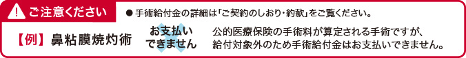女性のための医療保険フェミニーヌの手術給付金ご注意事項です。鼻粘膜焼灼術に対して手術給付金はお支払いできません。公的医療保険の手術料が算定される手術ですが、給付対象外のため手術給付金はお支払いできません。手術給付金の詳細はご契約のしおり約款をご覧ください。