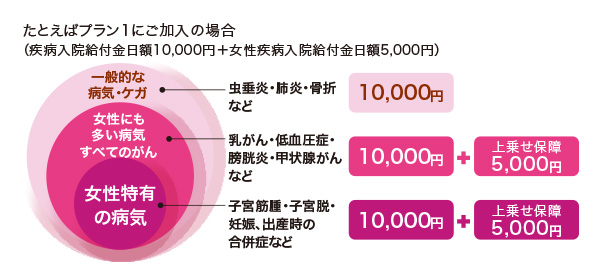 フェミニーヌの保障内容 プラン1の場合