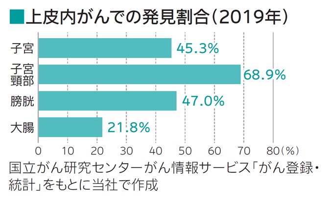 上皮内がんでの発見割合について説明しています。子宮は45.3％、子宮頚部は68.9％、膀胱は47％、大腸は21.8％が上皮内がんで発見されています。この図は国立がん研究センターがん情報サービス「がん登録・ 統計」をもとに当社で作成しています。