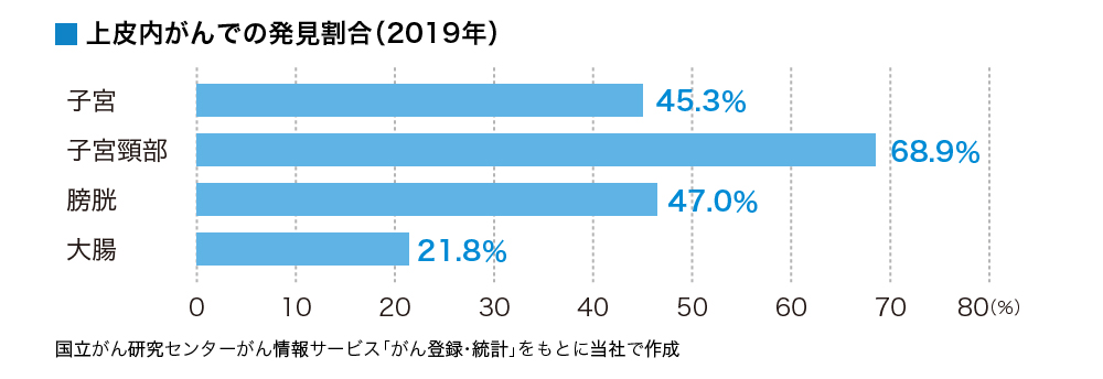 2019年の国立がん研究センターのがん登録、統計によると、がんが発見されたうち上皮内がんでの発見割合は子宮が45％、子宮頚部が69％、膀胱が47％、大腸が22％です。