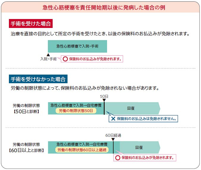 急性心筋梗塞を責任開始期以後に発病した場合の例